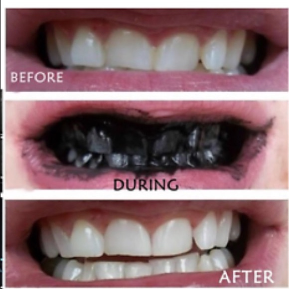 SOLD OUT - Picture 2 of 3